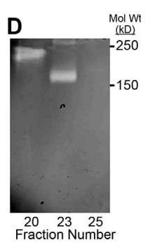 Gelatin zymography after extended electrophoresis.jpg